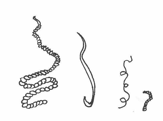 Parasites that cause disease of chickens often include (left to right): Tapeworms, Roundworms, Threadworms, and Cecal worms as illustrated above.