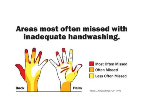 Areas Frequently Missed When Handwashing Graphic
