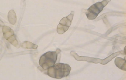 Figure 4: Conidia morphology (Alternaria mali) on the lesions of apple leaves.