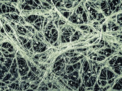 Close up of  mycorrhizae fibers.