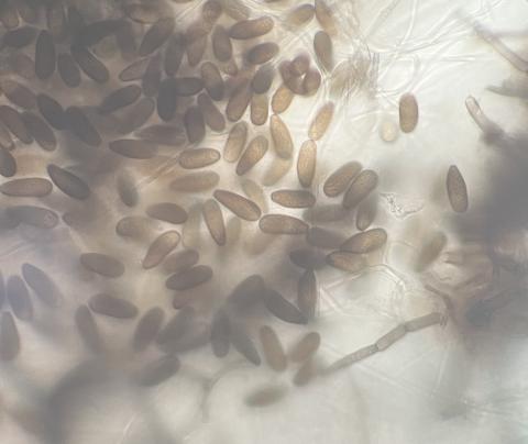 Figure 6. Asexual conidia of Botryosphaeria obtuse.