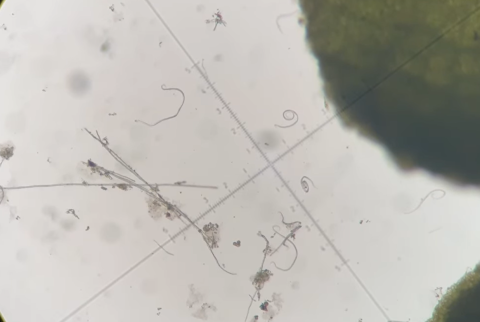 View of beach leaf disease nematodes under a microscope.